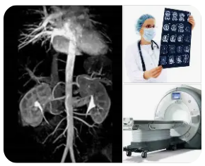 MRI Angiography (MRA) – A Practical Overview of Techniques