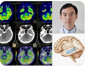 Epilepsy MRI Protocol: Key Points for Technologists