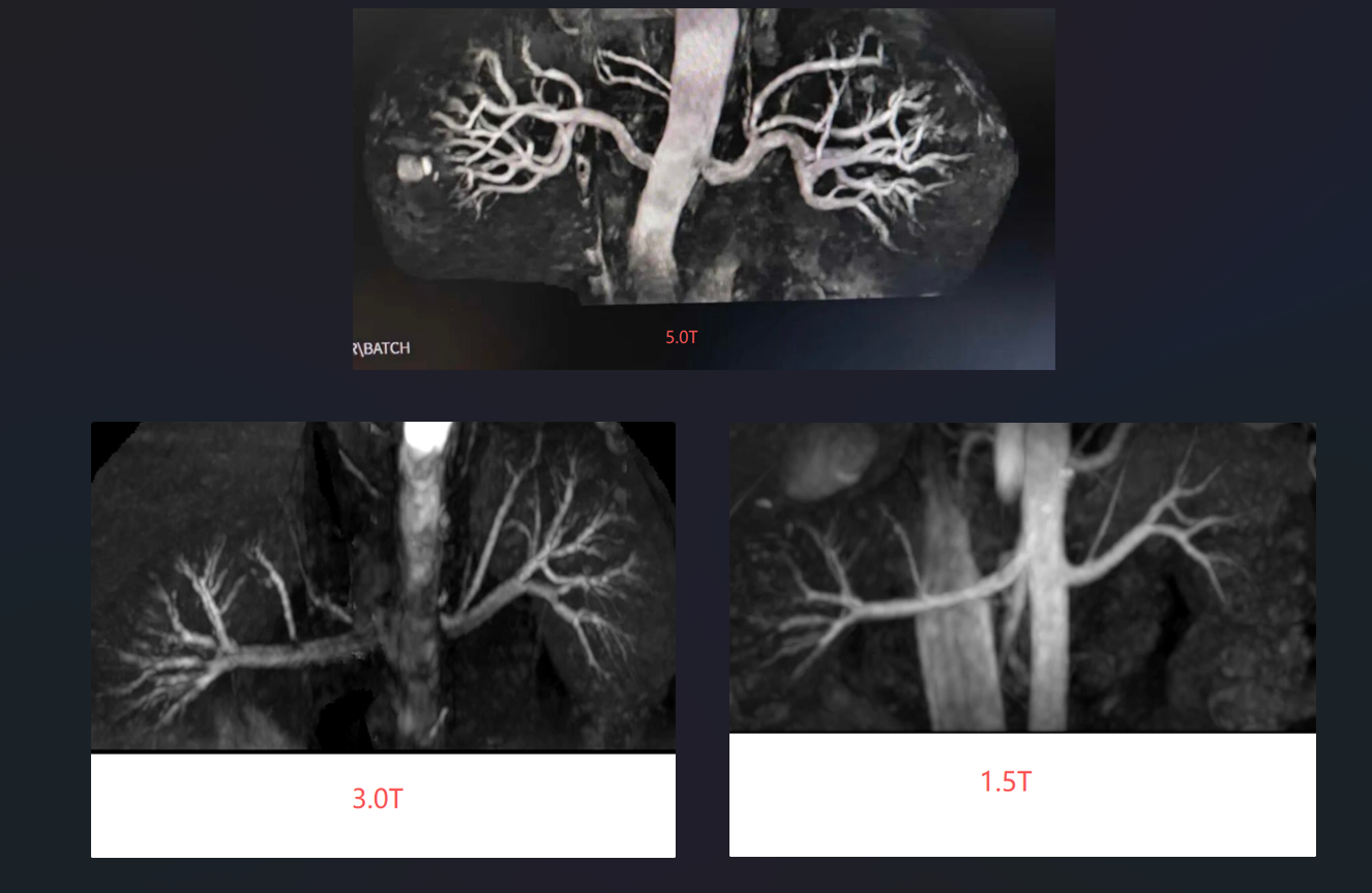 MRI renal artery in different field strength 5T, 3T and 1.5T